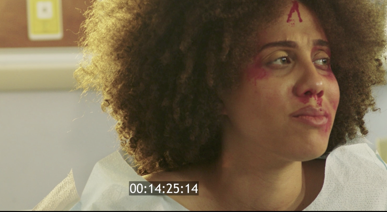 Performance still: Ashlyn in a hospital setting, holding a bloodied, emotionally restrained expression.